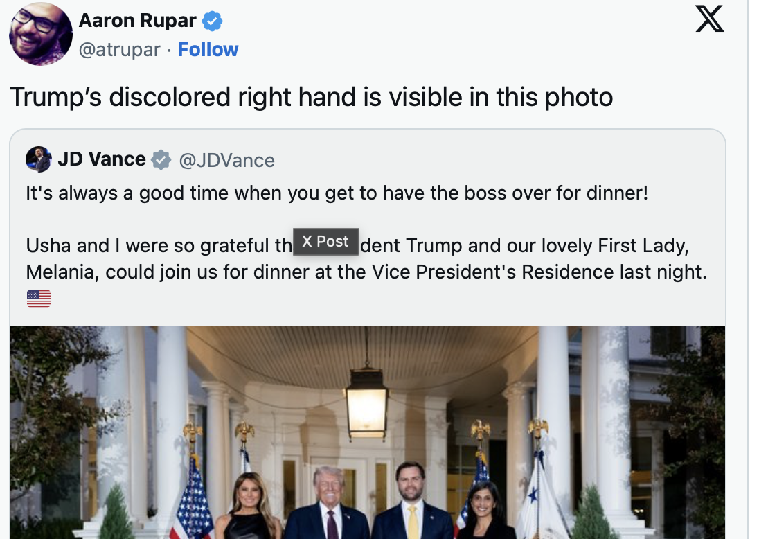 Is he dying? Trump’s discolored hand steals attention during double date with JD Vance and Usha